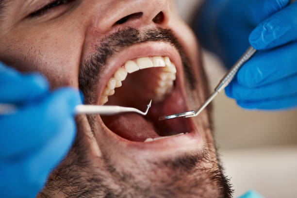 Best Knocked-Out Tooth Emergency  in El Cerro Mission, NM