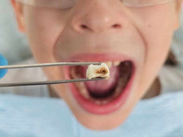 Best Tooth Infection Emergency Dentist  in El Cerro Mission, NM